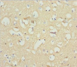 NCALD / Neurocalcin Delta Antibody