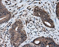 Monoclonal Mouse anti-Human HMRF1L / MTRF1L Antibody (clone OTI1H7, IHC, IF, WB)