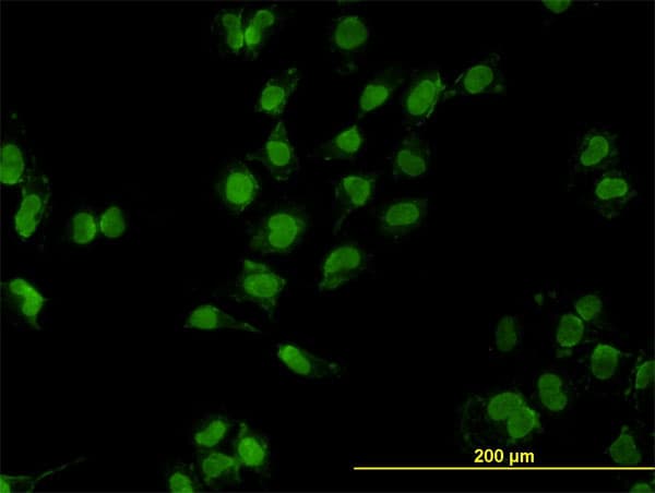 IHC-plus™ GAX / MEOX2 Antibody (clone 6A5)