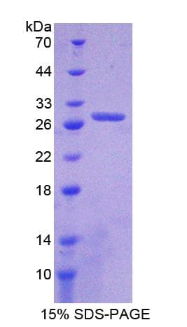 Rat ANGPT4 / Angiopoietin-4 Protein (Recombinant His-T7)