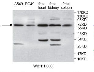 ZAP70 Antibody (aa71-303)