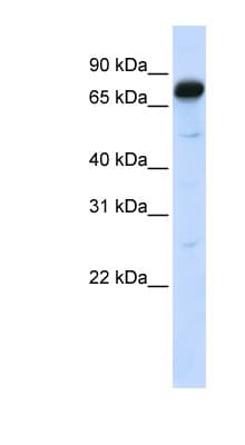 AMOT / Angiomotin Antibody (aa108-157)