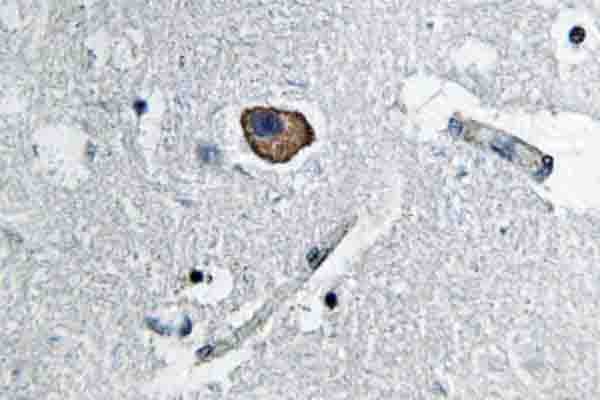 Polyclonal Rabbit anti-Human L1CAM Antibody (Arg1177, IHC, IF, WB)