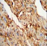 Polyclonal Rabbit anti-Human Myozenin / MYOZ1 Antibody (aa40-69, IHC, WB)