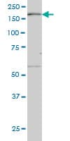 MAP3K4 / MEKK4 Antibody (clone 4F10)