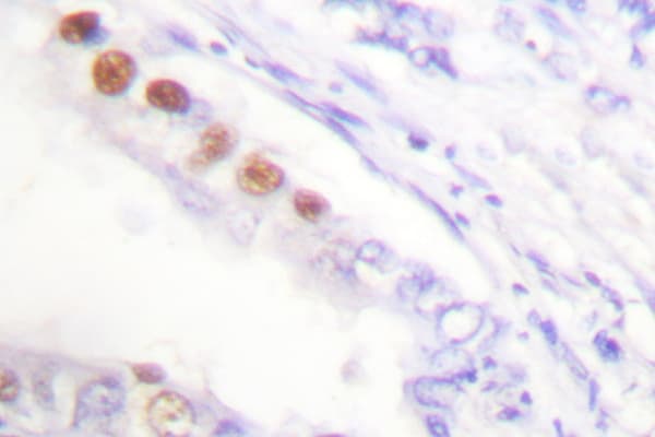 MKI67 / Ki67 Antibody (Val3242)