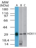 IHC-plus™ TLX1 / HOX11 Antibody (aa306-318)