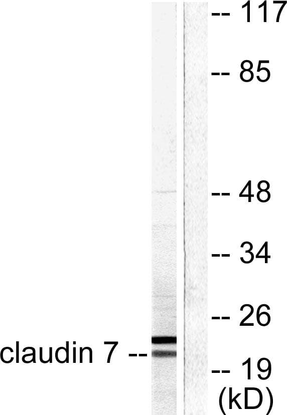 CLDN7 / Claudin 7 Antibody