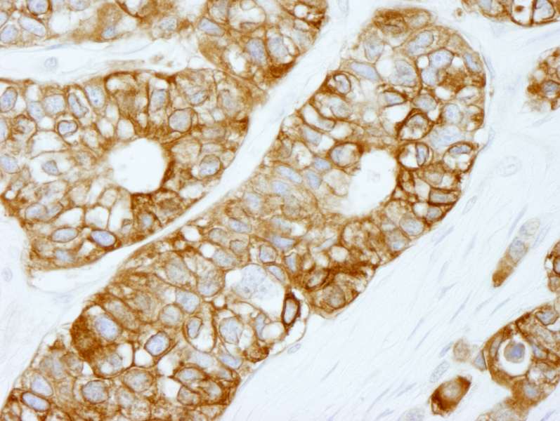 FASN / Fatty Acid Synthase Antibody (aa2462-2511)