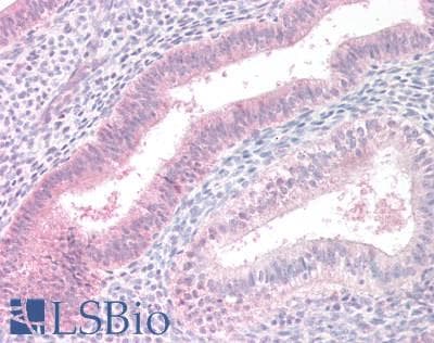 IHC-plus™ Polyclonal Goat anti-Human MTM1 / Myotubularin Antibody (aa590-603, IHC, WB)