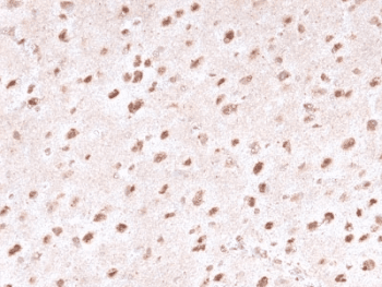 Ubiquitin Antibody (clone UBB/1748)