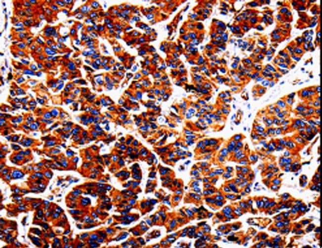 ADD1 / Adducin Alpha Antibody