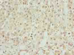 Polyclonal Rabbit anti-Human ZNF821 Antibody (IHC, WB)