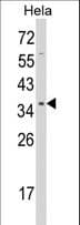 STRAP / MAWD Antibody (aa242-269)