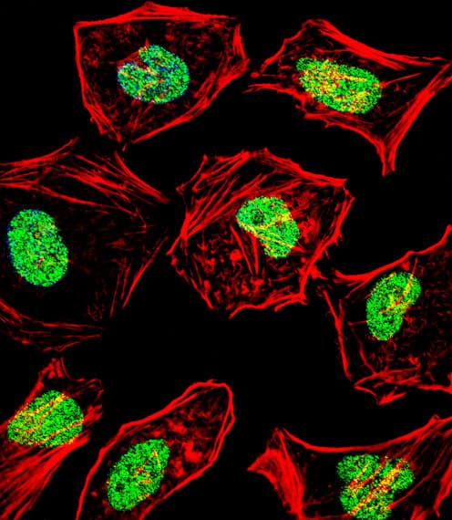 DHAND / HAND2 Antibody (aa81-110)