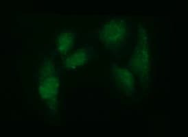ADAMTS8 Antibody (clone OTI2H5, Carrier-free)