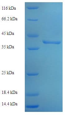 Human CINP Protein (Recombinant His-SUMO)