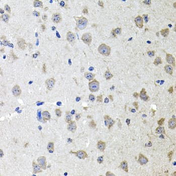 Polyclonal Rabbit anti-Human ALPL / Alkaline Phosphatase Antibody (IHC, WB)