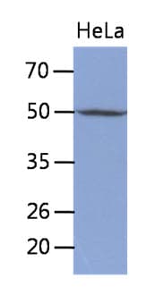 TDG / Thymine DNA Glycosylase Antibody (clone AT2F7)