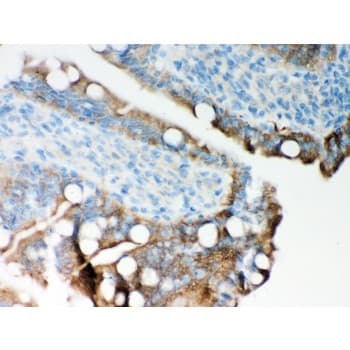 Polyclonal Rabbit anti-Human ITPR3 Antibody (aa70-95, IHC, WB)