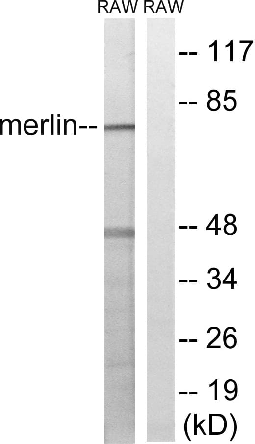 NF2 / Merlin Antibody (aa1-50)