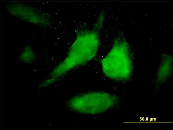 STAT1 Antibody (clone 1A8)