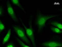 SOX5 Antibody (clone 7031C6a)