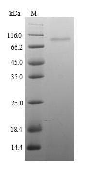 Rabbit ITGB8 / Integrin Beta 8 Protein (Recombinant 10His, N-terminus + Myc, C-terminus)