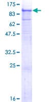 Human ADAM12 Protein (Recombinant GST)