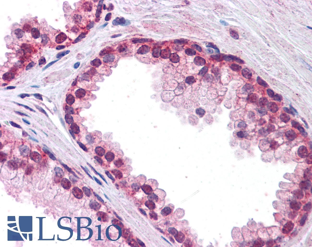 IHC-plus™ Polyclonal Goat anti-Human FOXP2 Antibody (aa484-497, IHC, WB)