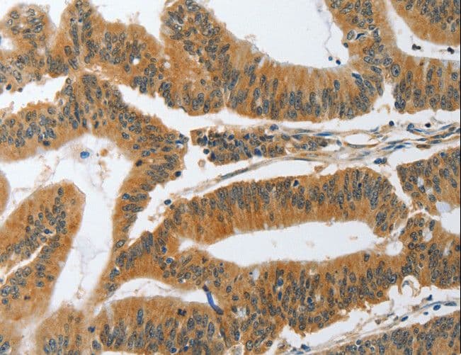 PIK3R3 / p85 Gamma Antibody