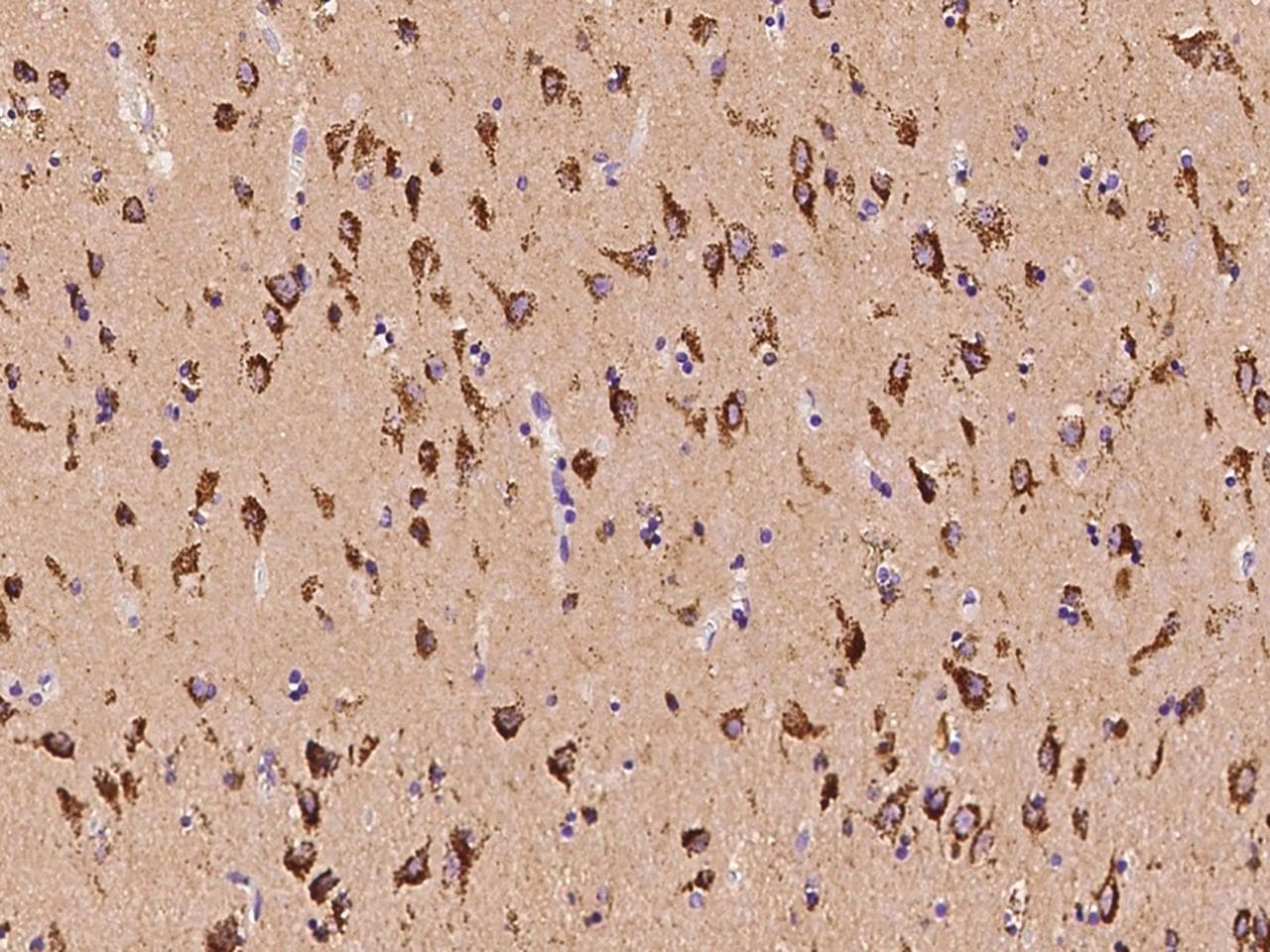 PITPNC1 Antibody