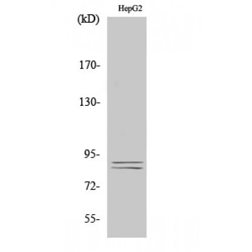 IKK Alpha+Beta Antibody (120-200 aa)