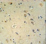 GRIA4 / GLUR4 Antibody (aa259-287)