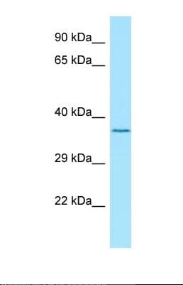 Polyclonal Rabbit anti-Human LGI4 Antibody (aa306-355, WB)