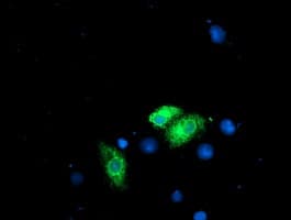 RPN1 / Ribophorin I Antibody (clone OTI3E1, Carrier-free)