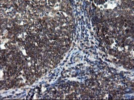 CNOT4 / CLONE243 Antibody (clone OTI1H2)