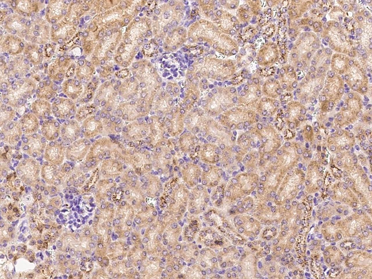 Polyclonal Rabbit anti-Mouse ADAMTS4 Antibody (Preservative Free, IHC)