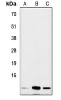 Insulin Antibody (Internal)