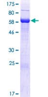 Human C16orf70 / LIN10 Protein (Recombinant GST)