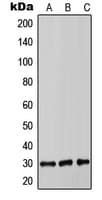 COMT Antibody (Internal)