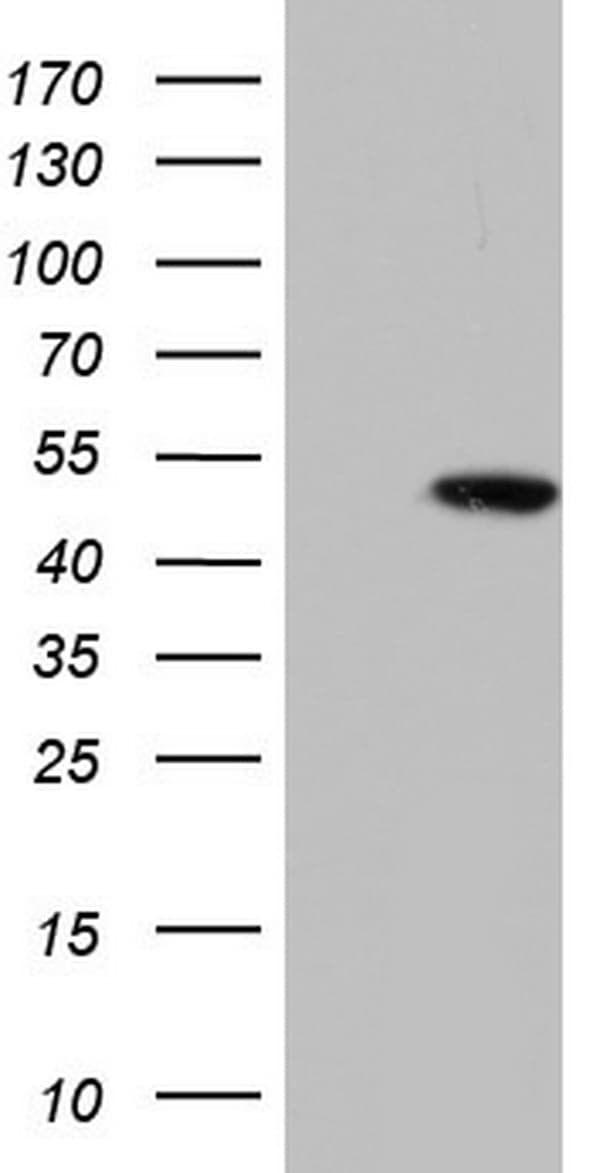 IHC-plus™ KRT19 / CK19 / Cytokeratin 19 Antibody (aa240-390, clone 8H7)