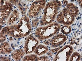 PRKAR2A Antibody (clone OTI1F8)