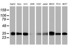 PSMA6 Antibody (clone OTI2A6)