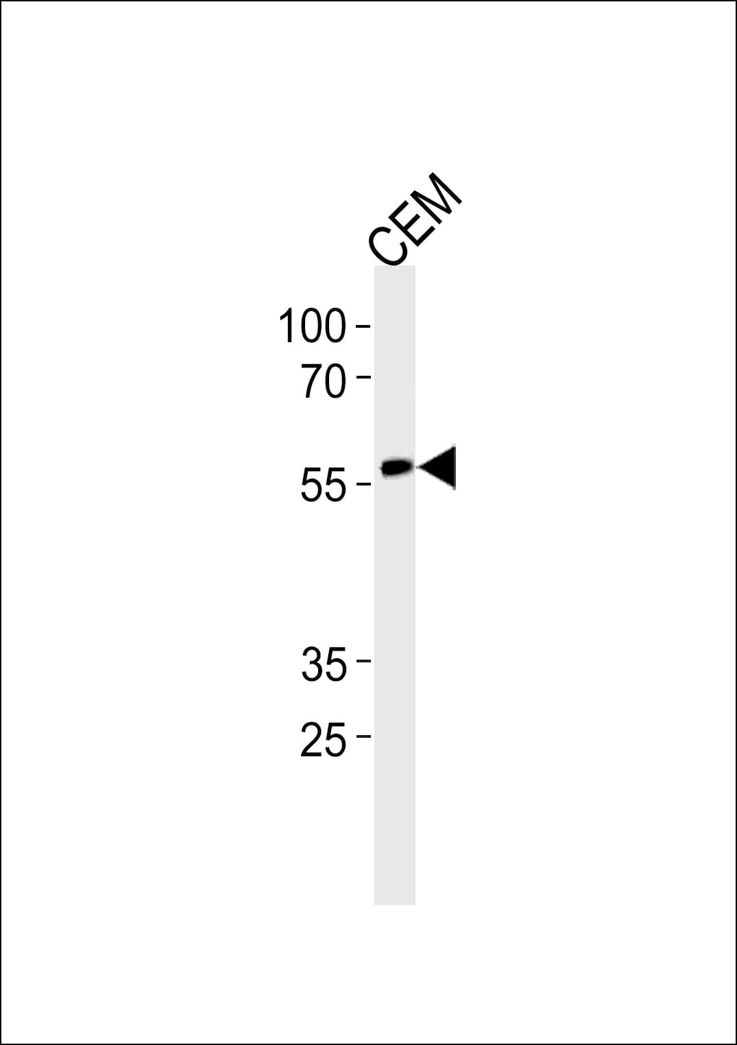 CBFA1 / RUNX2 Antibody (Ser533)