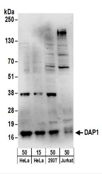 IHC-plus™ Polyclonal Rabbit anti-Human DAP Antibody (aa52-102, IHC, WB)