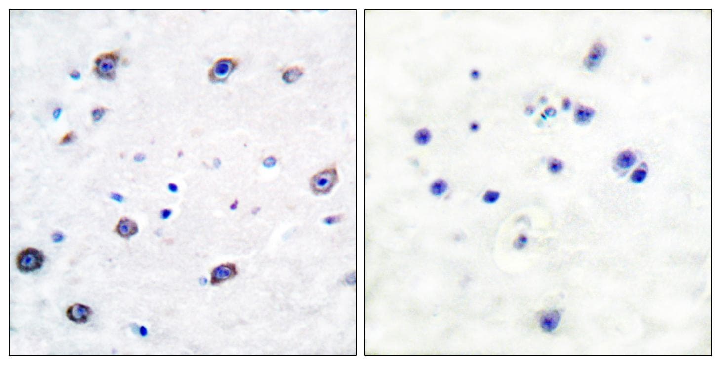ADD1 / Adducin Alpha Antibody (p726)