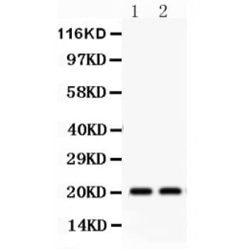HSPB2 / HSP27 Antibody (aa1-182)