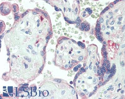 IHC-plus™ Polyclonal Rabbit anti-Human DLL4 Antibody (IHC)
