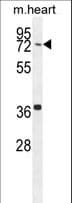 Polyclonal Rabbit anti-Human CCDC38 Antibody (aa352-380, IHC, WB)